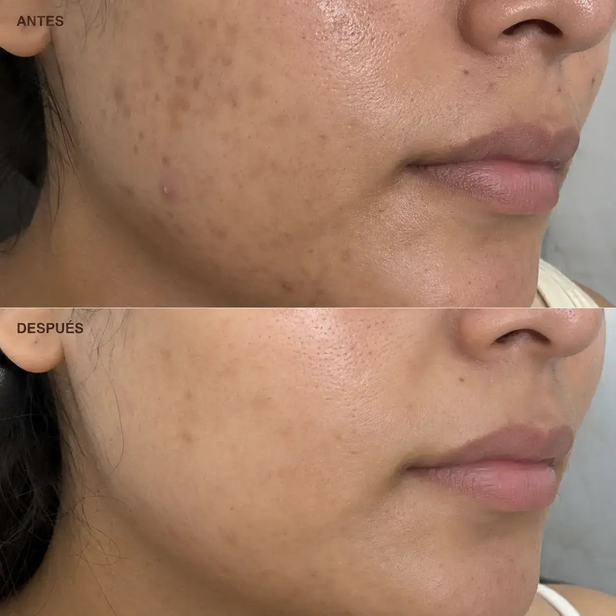 Anua Niacinamide 10 Txa 4 Serum
